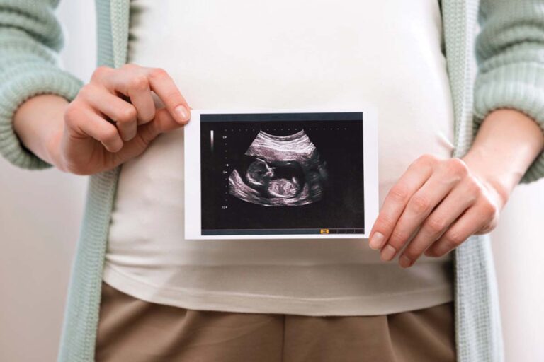 Pregnant woman holding an ultrasound photo that shows an unborn baby