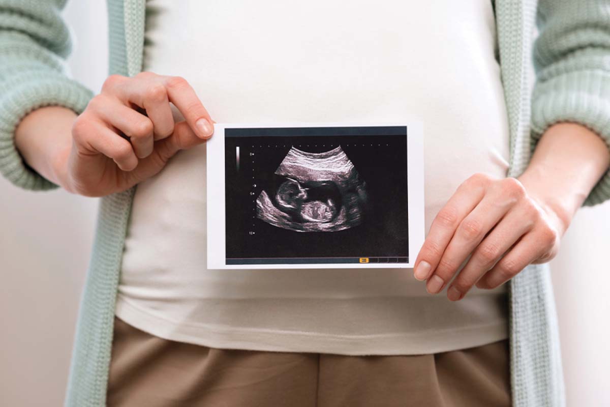 Pregnant woman holding an ultrasound photo that shows an unborn baby